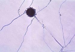 Aspergillus Mold Photo - Types Of Mold
